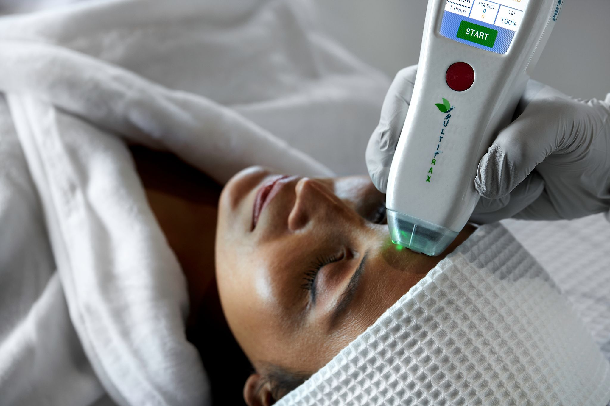 Pièce à main Multifrax, laser fractionné portable